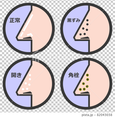 鼻の毛穴の状態を表すイラスト 82043038