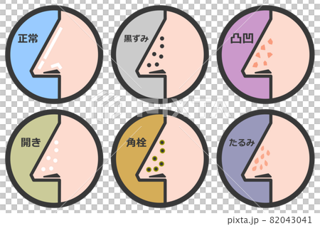 鼻の毛穴の状態を表すイラスト 82043041