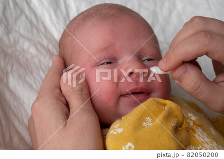 Cleaning newborn nose from boogers with a cotton swab Cleaning newborn nose from boogers with a cotton swab 82050200