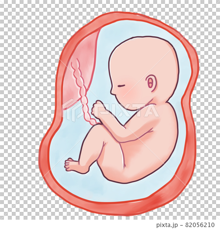 妊娠後期の赤ちゃんのイラスト（逆子） 82056210
