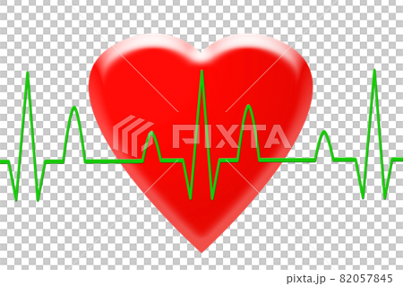 ECG waveform image 82057845