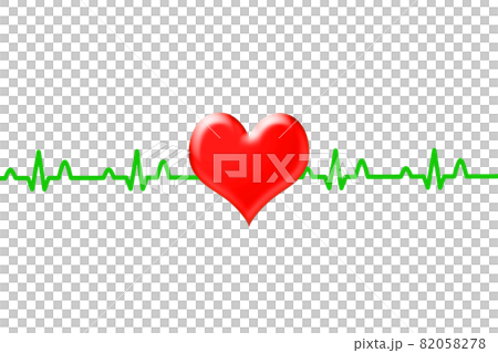 ECG waveform image 82058278