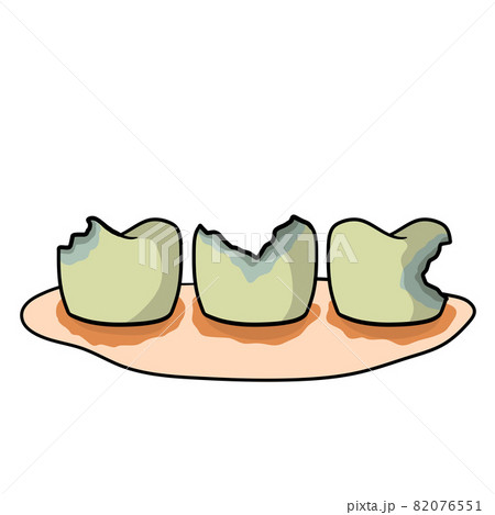 Caries and dental problems. Dentistry and sick dirty teeth. Caries and dental problems. Dentistry and sick dirty teeth. 82076551