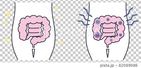 腸道活動腸道簡單圖解 腸道活動腸道簡單圖解 82089086