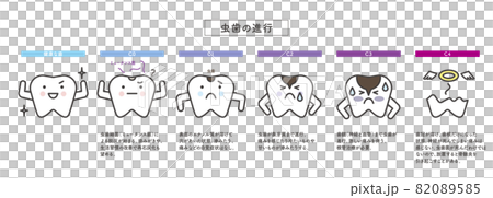 シンプル　イラスト　虫歯の進行　歯のキャラクター 82089585