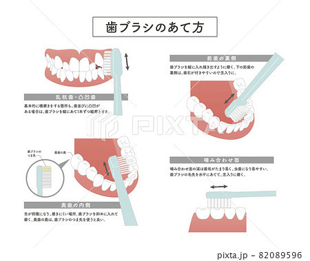 歯ブラシの当て方のイラストのイラスト素材 0596