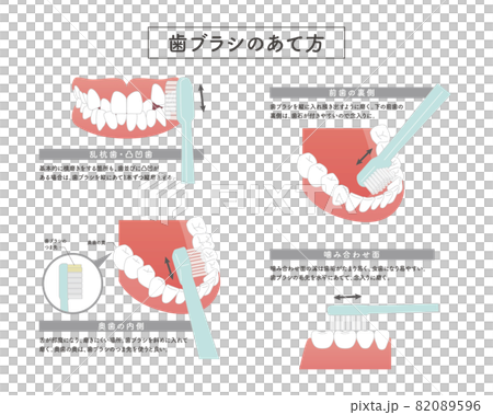 歯ブラシの当て方のイラスト 歯ブラシの当て方のイラスト 82089596