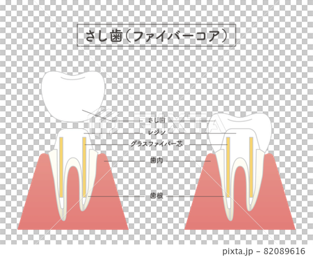 Structural illustration of cutting teeth 82089616