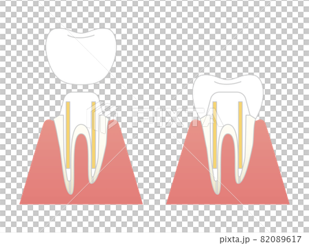 Structural illustration of cutting teeth 82089617
