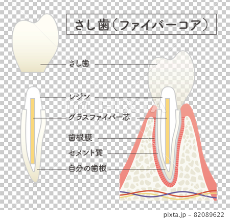 Structural illustration of cutting teeth 82089622