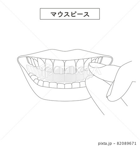 マウスピースを装着するイラスト 82089671