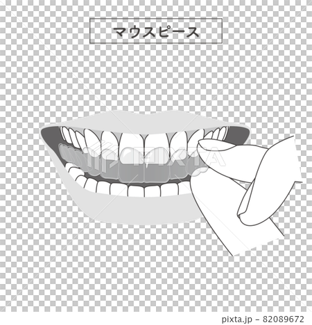 マウスピースを装着するイラスト 82089672