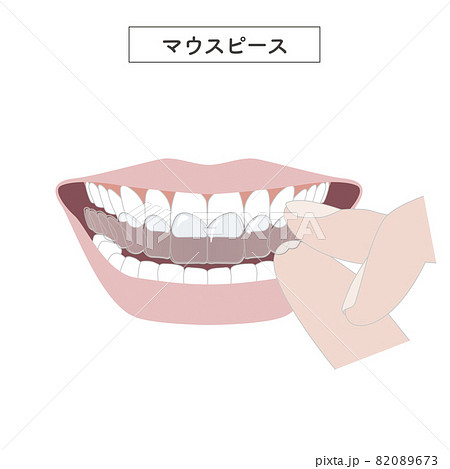 マウスピースを装着するイラスト マウスピースを装着するイラスト 82089673