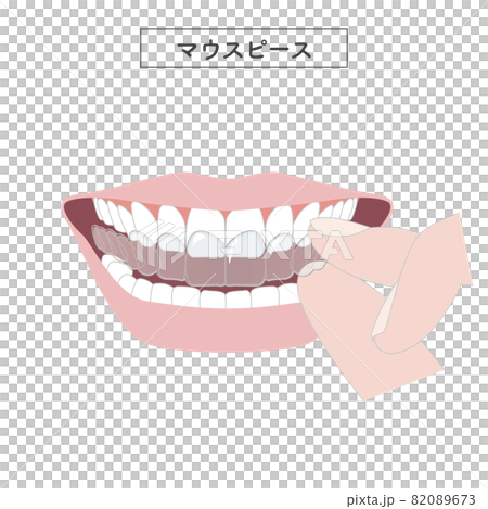 マウスピースを装着するイラスト マウスピースを装着するイラスト 82089673
