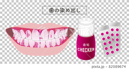 Tooth dyeing set illustration Tooth dyeing set illustration 82089674