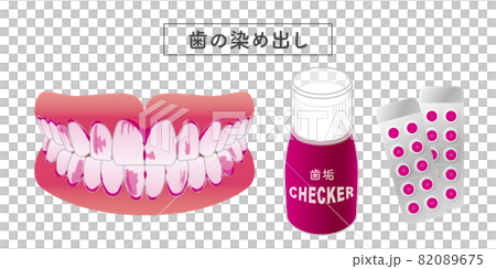 歯垢の染め出し セットイラスト 歯垢の染め出し セットイラスト 82089675