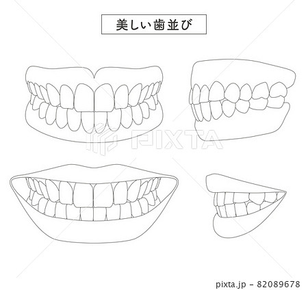 美しい歯並び　セットイラスト 82089678