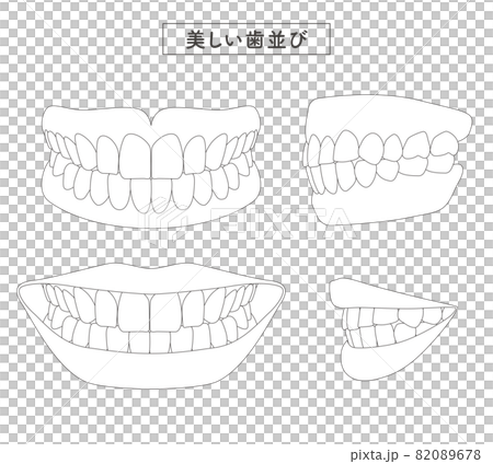 美しい歯並び　セットイラスト 82089678