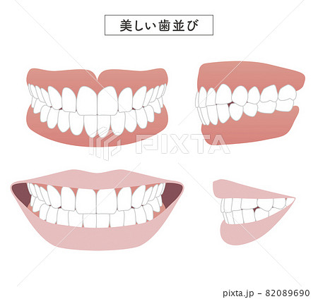 美しい歯並び セットイラスト 美しい歯並び セットイラスト 82089690