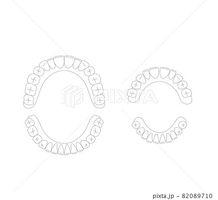 永久歯と乳歯の歯並び 82089710