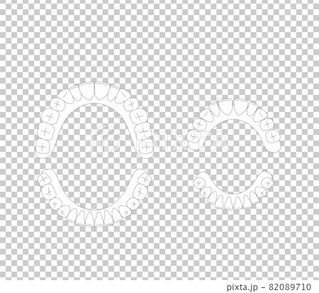 永久歯と乳歯の歯並び 82089710