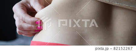 Woman shows excess fat on her sides Woman shows excess fat on her sides 82152267