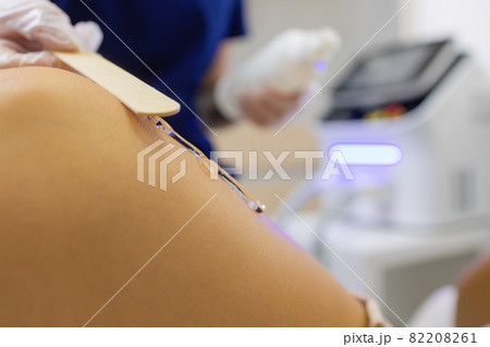 Beautician Giving Epilation Laser Treatment To Woman On Thigh. Beautician Giving Epilation Laser Treatment To Woman On Thigh. 82208261