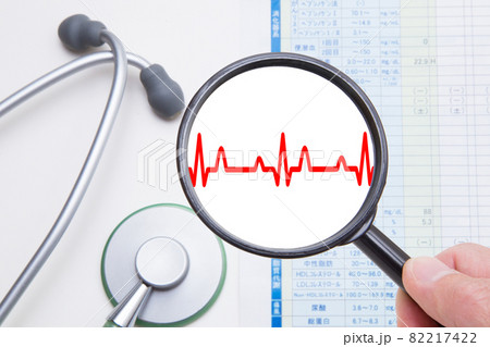 心電図 心臓の病気 医療イメージ 心電図 心臓の病気 医療イメージ 82217422