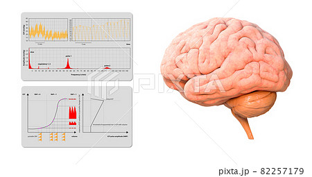 Intracranial Pressure Monitoring ICP waveform, 3d render, 2d graphic Intracranial Pressure Monitoring ICP waveform, 3d render, 2d graphic 82257179