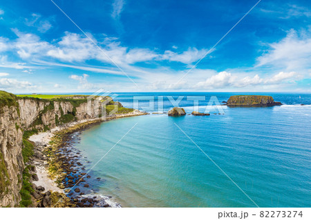 Carrick-a-Rede, Causeway Coast 82273274
