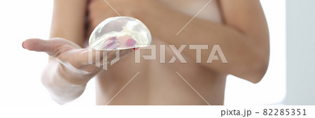 Nude female patient holds silicone breast implant in her hand 82285351