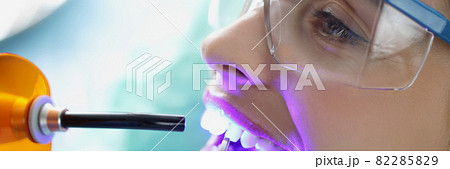Doctor dentist shining on teeth of female patient curing light closeup 82285829