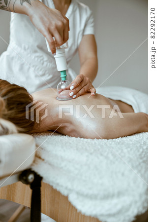 professional female specialist is doing cupping therapy on the back of beautiful caucasian lady 82292170