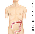 イラスト素材：右結腸がん003（リアル） 82342064
