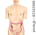 イラスト素材：右結腸がん001（リアル） 82342066
