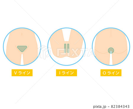 ボディパーツ　VIO　脱毛箇所　ベクターイラスト　女性 82384343