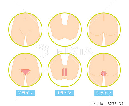 ボディパーツ　VIO　脱毛箇所　ベクターイラスト　女性 82384344