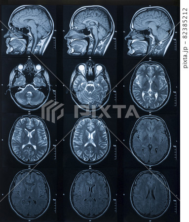 MRI scan of the brain. Medicine and Health MRI scan of the brain. Medicine and Health 82385212