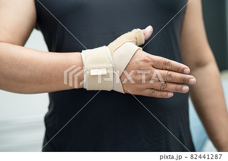 Asian middle-aged lady woman use elastic bandage to treating De Quervain syndrome at hand and finger in office. Asian middle-aged lady woman use elastic bandage to treating De Quervain syndrome at hand and finger in office. 82441287