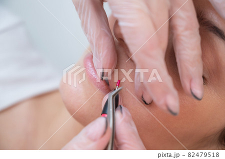 Woman on electric hair removal of antennae. Hardware permanent removal of unwanted facial hair. 82479518