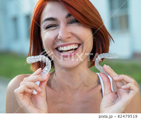 Red-haired Caucasian woman holding transparent mouthguards for bite correction outdoors. A girl with a beautiful snow-white smile uses silicone braces 82479519
