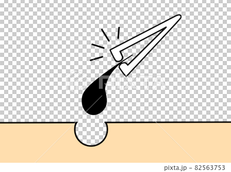 tweezers tweezers 82563753