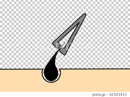 鑷子 鑷子 82563913