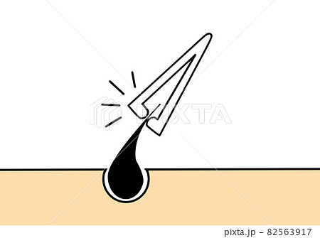 毛抜き 毛抜き 82563917