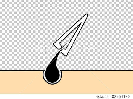 鑷子 鑷子 82564380