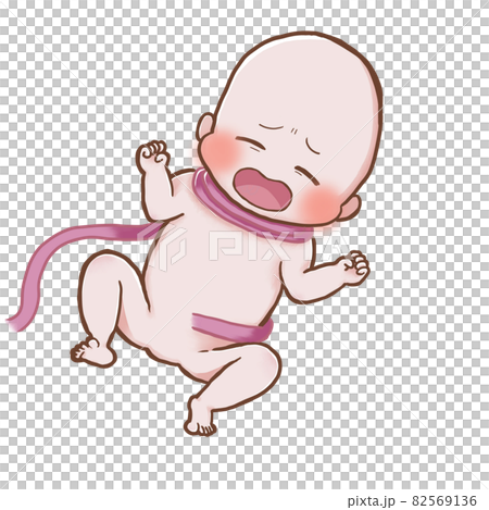 Baby birth illustration with umbilical cord wrapped around the neck Baby birth illustration with umbilical cord wrapped around the neck 82569136