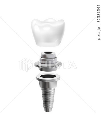 Dental Post Icon 82581545