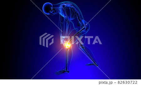 Knee joint pain Anatomy For Medical Concept 3D 82630722