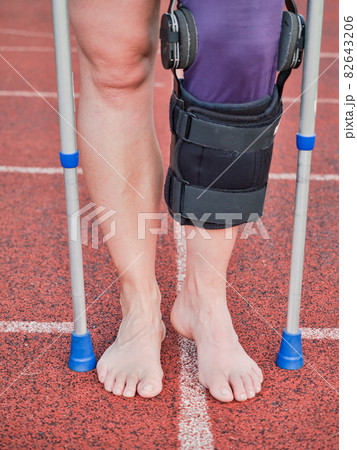 Woman suffering with walk by sticks and knee brace support surgery Woman suffering with walk by sticks and knee brace support surgery 82643206