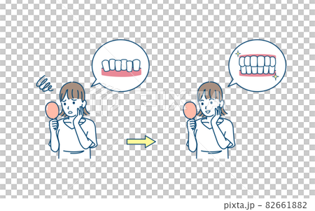 歯並びを気にする若い女性　歯の悩み　コンプレックス　治療　歯列矯正　矯正後　イラスト素材 82661882